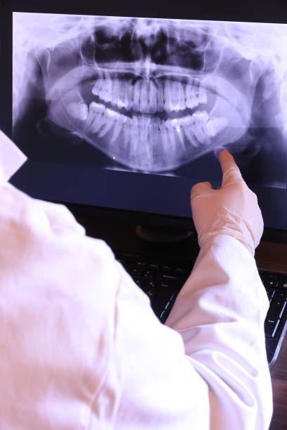 Best Emergency Root Canal Treatment in Stanberry, MO